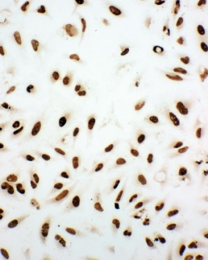 ICC analysis of XRCC5 using anti-XRCC5 antibody (PA1641).