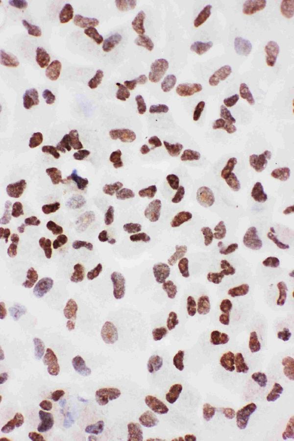 ICC analysis of XRCC6 using anti-XRCC6 antibody (PA1642).