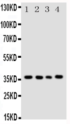 Anti-Bub3 antibody, PA1645, Western blotting All lanes: Anti Bub3 (PA1645) at 0.5ug/ml Lane 1: HELA Whole Cell Lysate at 40ug Lane 2: A549 Whole Cell Lysate at 40ug Lane 3: JURKAT Whole Cell Lysate at 40ug Lane 4: COLO320 Whole Cell Lysate at 40ug Predicted bind size: 37KD Observed bind size: 37KD