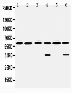 Anti-MAOB antibody, PA1649, Western blotting All lanes: Anti MAOB (PA1649) at 0.5ug/ml