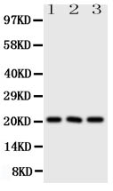 Western blot analysis of FGF21 using anti-FGF21 antibody (PA1673). Electrophoresis was performed on a 5-20% SDS-PAGE gel at 70V (Stacking gel) / 90V (Resolving gel) for 2-3 hours. The sample well of each lane was loaded with 50ug of sample under reducing conditions. Lane 1: A549 Whole Cell Lysate, Lane 2: A431 Whole Cell Lysate, Lane 3: HEPA Whole Cell Lysate. After Electrophoresis, proteins were transferred to a Nitrocellulose membrane at 150mA for 50-90 minutes. Blocked the membrane with 5% Non-fat Milk/ TBS for 1.5 hour at RT. The membrane was incubated with rabbit anti-FGF21 antigen affinity purified polyclonal antibody (Catalog # PA1673) at 0.5 μg/mL overnight at 4°C, then washed with TBS-0.1%Tween 3 times with 5 minutes each and probed with a goat anti-rabbit IgG-HRP secondary antibody at a dilution of 1:10000 for 1.5 hour at RT. The signal is developed using an Enhanced Chemiluminescent detection (ECL) kit (Catalog # EK1002) with Tanon 5200 system. A specific band was detected for FGF21 at approximately 21KD. The expected band size for FGF21 is at 21KD.