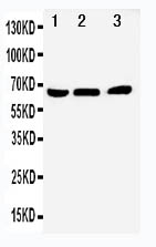 Anti-NUR77 antibody, PA1676, Western blotting Lane 1: A431 Cell Lysate Lane 2: HELA Cell Lysate Lane 3: JURKAT Cell Lysate