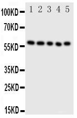 Anti-ERp57 antibody, PA1679, Western blotting Lane 1: SMMC Cell Lysate Lane 2: A549 Cell Lysate Lane 3: U87 Cell Lysate Lane 4: HELA Cell Lysate Lane 5: MCF-7 Cell Lysate