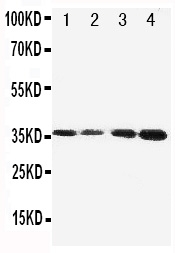 Western blot analysis of Protein C using anti-Protein C antibody (PA1682). Electrophoresis was performed on a 5-20% SDS-PAGE gel at 70V (Stacking gel) / 90V (Resolving gel) for 2-3 hours. The sample well of each lane was loaded with 50ug of sample under reducing conditions. Lane 1: JURKAT Cell Lysate Lane 2: CEM Cell Lysate Lane 3: SMMC Cell Lysate Lane 4: HELA Cell Lysate. After Electrophoresis, proteins were transferred to a Nitrocellulose membrane at 150mA for 50-90 minutes. Blocked the membrane with 5% Non-fat Milk/ TBS for 1.5 hour at RT. The membrane was incubated with rabbit anti-Protein C antigen affinity purified polyclonal antibody (Catalog # PA1682) at 0.5 μg/mL overnight at 4°C, then washed with TBS-0.1%Tween 3 times with 5 minutes each and probed with a goat anti-rabbit IgG-HRP secondary antibody at a dilution of 1:10000 for 1.5 hour at RT. The signal is developed using an Enhanced Chemiluminescent detection (ECL) kit (Catalog # EK1002) with Tanon 5200 system. A specific band was detected for Protein C at approximately 36KD. The expected band size for Protein C is at 52KD.