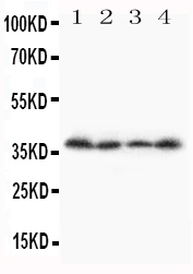 Anti-Stra8 antibody, PA1685, Western blotting Lane 1: A231 Cell Lysate Lane 2: JURKAT Cell Lysate Lane 3: HT1080 Cell Lysate Lane 4: SCG Cell Lysate