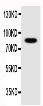 Anti-NLRP4G antibody, PA1687, Western blotting WB: Mouse Ovary Tissue Lysate