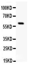 Anti-SSTR1 antibody, PA1693, Western blotting All lanes: Anti SSTR1 (PA1693) at 0.5ug/ml WB: Rat Intestine Tissue Lysate at 50ug Predicted bind size: 43KD Observed bind size: 60KD