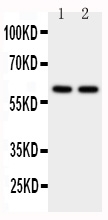 Anti-CYP11A1 antibody, PA1698, Western blotting WB: Human Placenta Tissue Lysate