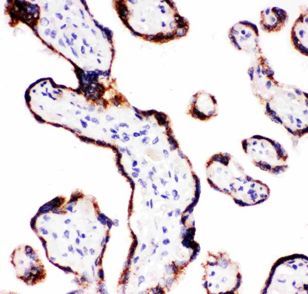 Anti-CYP11A1 antibody, PA1698, IHC(P) IHC(P): Human Placenta Tissue