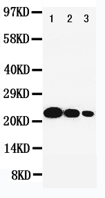 Anti-IL-6 antibody, PA1700, Western blotting Lane 1: Recombinant Human IL-6 Protein 10ng Lane 2: Recombinant Human IL-6 Protein 5ng Lane 3: Recombinant Human IL-6 Protein 2.5ng