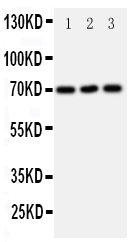 Anti-SLC6A4 antibody, PA1705, Western blotting All lanes: Anti SLC6A4 (PA1705) at 0.5ug/ml