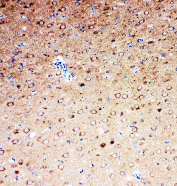 Anti-SLC6A4 antibody, PA1706, IHC(P) IHC(P): Rat Brain Tissue