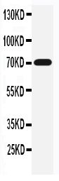 Anti-SLC6A4 antibody, PA1706, Western blotting WB: Rat Brain Tissue Lysate