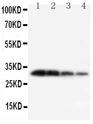 Anti-Kallikrein 1 antibody, PA1709, Western blotting Lane 1: Recombinant Mouse KLK1 Protein 10ng Lane 2: Recombinant Mouse KLK1 Protein 5ng Lane 3: Recombinant Mouse KLK1 Protein 2.5ng Lane 4: Recombinant Mouse KLK1 Protein 1.25ng