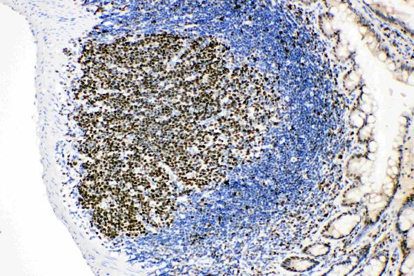 Anti-MCM2 antibody, PA1711, IHC(P) IHC(P): Rat Intestinal Lymphocyte Tissue