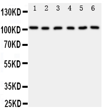 Anti-MCM2 antibody, PA1711, Western blotting All lanes: Anti MCM2 (PA1711) at 0.5ug/ml