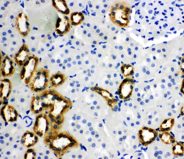 IHC analysis of PEBP1 using anti-PEBP1 antibody (PA1713).