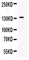 Anti-CD62P antibody, PA1715, Western blotting All lanes: Anti CD62P (PA1715) at 0.5ug/ml WB: PANC Whole Cell Lysate at 40ug Predicted bind size: 91KD Observed bind size: 140KD