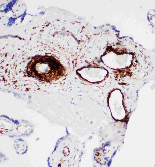 Anti-SERCA1 ATPase antibody, PA1719, IHC(P) IHC(P): Human Placenta Tissue