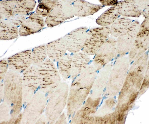 Anti-SERCA1 ATPase antibody, PA1719, IHC(P) IHC(P): Rat Skeletal Muscle Tissue