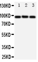 Anti-ABCB6 antibody, PA1723, Western blotting All lanes: Anti ABCB6 (PA1723) at 0.5ug/ml