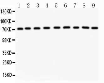 Anti-GHR antibody, PA1726, Western blotting All lanes: Anti GHR (PA1726) at 0.5ug/ml Lane 1: Rat Liver Tissue Lysate at 50ug Lane 2: Rat Kidney Tissue Lysate at 50ug Lane 3: Rat Spleen Tissue Lysate at 50ug Lane 4: Rat Intestine Tissue Lysate at 50ug Lane 5: Mouse Spleen Tissue Lysate at 50ug Lane 6: Mouse Testis Tissue Lysate at 50ug Lane 7: Mouse Liver Tissue Lysate at 50ug Lane 8: Mouse Kidney Tissue Lysate at 50ug Lane 9: Mouse Intestine Tissue Lysate at 50ug Predicted bind size: 72KD Observed bind size: 72KD