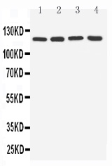 Anti-TLR7 antibody, PA1733, Western blotting Lane 1: Rat Spleen Tissue Lysate Lane 2: Rat Liver Tissue Lysate Lane 3: U87 Cell Lysate Lane 4: A549 Cell Lysate