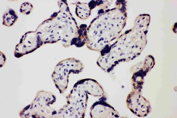 Anti-TLR7 antibody, PA1733, IHC(P) IHC(P): Human Placenta Tissue