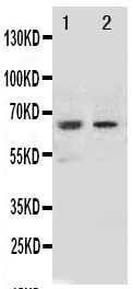 Anti-NOX1 antibody, PA1739, Western blotting All lanes: Anti NOX1 (PA1739) at 0.5ug/ml