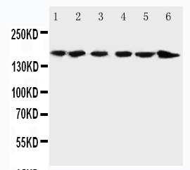 Anti-ALK antibody, PA1741, Western blotting Lane 1: Rat Brain Tissue Lysate Lane 2: Rat Testis Tissue Lysate Lane 3: U87 Cell Lysate Lane 4: HELA Cell Lysate Lane 5: COLO320 Cell Lysate Lane 6: JURKAT Cell Lysate