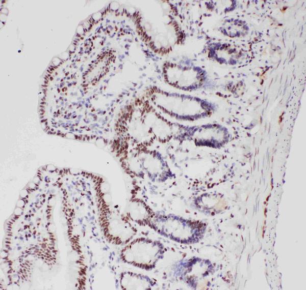 Anti-ALK antibody, PA1741, IHC(P) IHC(P): Rat Intestine Tissue