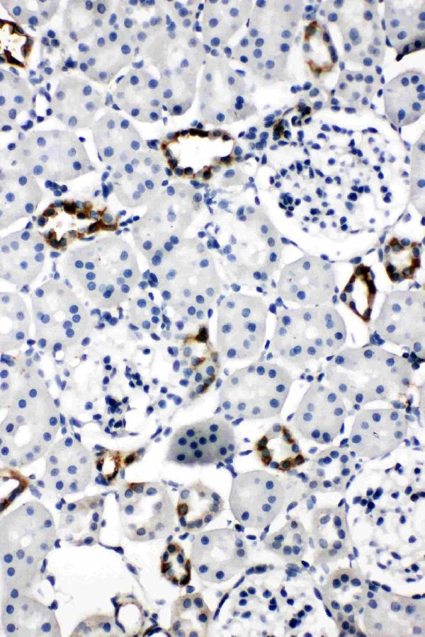 Anti-Aquaporin 2 antibody, PA1742, IHC(P) IHC(P): Rat Kidney Tissue