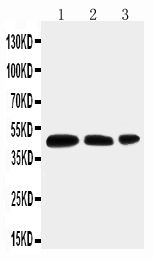 Anti-Aquaporin 2 antibody, PA1742, Western blotting Lane 1: MCF-7 Cell Lysate Lane 2: SW620 Cell Lysate Lane 3: HT1080 Cell Lysate