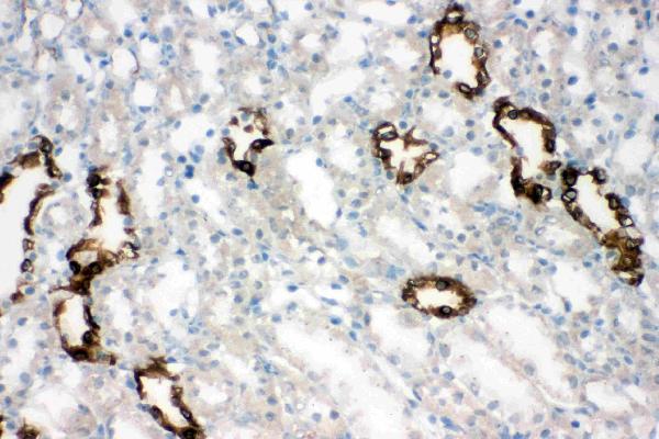 Anti-Aquaporin 2 antibody, PA1742, IHC(F) IHC(F): Rat Kidney Tissue