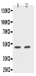 Anti-CD2 antibody, PA1743, Western blotting Lane 1: Rat Spleen Cell Lysate Lane 2: NIH/3T3 Cell Lysate