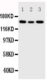 Anti-IGF1 Receptor antibody, PA1746, Western blotting Lane 1: 293T Cell Lysate Lane 2: A549 Cell Lysate Lane 3: MCF-7 Cell Lysate