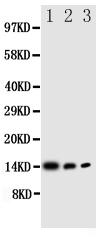 Anti-IL-4 antibody, PA1749, Western blotting All lanes: Anti IL-4 (PA1749) at 0.5ug/ml