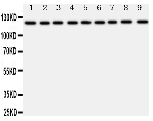 Anti-TRPC3 antibody, PA1753, Western blotting All lanes: Anti TRPC3 (PA1753) at 0.5ug/ml Lane 1: Rat Liver Tissue Lysate at 50ug Lane 2: Rat Lung Tissue Lysate at 50ug Lane 3: Rat Intestine Tissue Lysate at 50ug Lane 4: Rat Ovary Tissue Lysate at 50ug Lane 5: U87 Whole Cell Lysate at 40ug Lane 6: A549 Whole Cell Lysate at 40ug Lane 7: COLO320 Whole Cell Lysate at 40ug Lane 8: SW620 Whole Cell Lysate at 40ug Lane 9: HELA Whole Cell Lysate at 40ug Predicted bind size: 97KD Observed bind size: 120KD