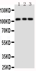 Western blot analysis of TRPC6 using anti-TRPC6 antibody (PA1754). Electrophoresis was performed on a 5-20% SDS-PAGE gel at 70V (Stacking gel) / 90V (Resolving gel) for 2-3 hours. The sample well of each lane was loaded with 50ug of sample under reducing conditions. Lane 1: Rat Lung Tissue Lysate Lane 2: 293T Cell Lysate Lane 3: 293T Cell Lysate After Electrophoresis, proteins were transferred to a Nitrocellulose membrane at 150mA for 50-90 minutes. Blocked the membrane with 5% Non-fat Milk/ TBS for 1.5 hour at RT. The membrane was incubated with rabbit anti-TRPC6 antigen affinity purified polyclonal antibody (Catalog # PA1754) at 0.5 μg/mL overnight at 4°C, then washed with TBS-0.1%Tween 3 times with 5 minutes each and probed with a goat anti-rabbit IgG-HRP secondary antibody at a dilution of 1:10000 for 1.5 hour at RT. The signal is developed using an Enhanced Chemiluminescent detection (ECL) kit (Catalog # EK1002) with Tanon 5200 system. A specific band was detected for TRPC6 at approximately 106-120KD. The expected band size for TRPC6 is at 106KD.