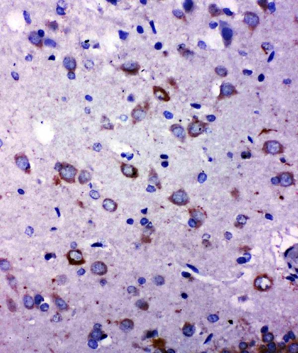 IHC analysis of TRPC6 using anti-TRPC6 antibody (PA1754). TRPC6 was detected in paraffin-embedded section of Rat Brain tissues. Heat mediated antigen retrieval was performed in citrate buffer (pH6, epitope retrieval solution) for 20 mins. The tissue section was blocked with 10% goat serum. The tissue section was then incubated with 1μg/ml rabbit anti-TRPC6 Antibody (PA1754) overnight at 4°C. Biotinylated goat anti-rabbit IgG was used as secondary antibody and incubated for 30 minutes at 37°C. The tissue section was developed using Strepavidin-Biotin-Complex (SABC)(Catalog # SA1022) with DAB as the chromogen.