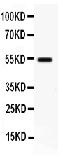 Anti-VIPR1 antibody, PA1756, Western blotting All lanes: Anti VIPR1 (PA1756) at 0.5ug/ml WB: Human Placenta Tissue Lysate at 50ug Predicted bind size: 52KD Observed bind size: 52KD