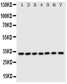 Western blot analysis of DCI using anti-DCI antibody (PA1763). Electrophoresis was performed on a 5-20% SDS-PAGE gel at 70V (Stacking gel) / 90V (Resolving gel) for 2-3 hours. The sample well of each lane was loaded with 50ug of sample under reducing conditions. Lane 1: Rat Liver Tissue Lysate, Lane 2: Human Placenta Tissue Lysate, Lane 3: A549 Whole Cell Lysate, Lane 4: SMMC Whole Cell Lysate, Lane 5: COLO320 Whole Cell Lysate, Lane 6: HELA Whole Cell Lysate, Lane 7: HT1080 Whole Cell Lysate, After Electrophoresis, proteins were transferred to a Nitrocellulose membrane at 150mA for 50-90 minutes. Blocked the membrane with 5% Non-fat Milk/ TBS for 1.5 hour at RT. The membrane was incubated with rabbit anti-DCI antigen affinity purified polyclonal antibody (Catalog # PA1763) at 0.5 μg/mL overnight at 4°C, then washed with TBS-0.1%Tween 3 times with 5 minutes each and probed with a goat anti-rabbit IgG-HRP secondary antibody at a dilution of 1:10000 for 1.5 hour at RT. The signal is developed using an Enhanced Chemiluminescent detection (ECL) kit (Catalog # EK1002) with Tanon 5200 system. A specific band was detected for DCI at approximately 33KD. The expected band size for DCI is at 33KD.