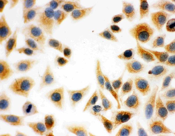 IHC analysis of DCI using anti-DCI antibody (PA1763). DCI was detected in immunocytochemical section of human HeLa cell. Enzyme antigen retrieval was performed using IHC enzyme antigen retrieval reagent (AR0022) for 15 mins. The cells were blocked with 10% goat serum. And then incubated with 1μg/ml rabbit anti-DCI Antibody (PA1763) overnight at 4°C. Biotinylated goat anti-rabbit IgG was used as secondary antibody and incubated for 30 minutes at 37°C. The section was developed using Strepavidin-Biotin-Complex (SABC)(Catalog # SA1022) with DAB as the chromogen.