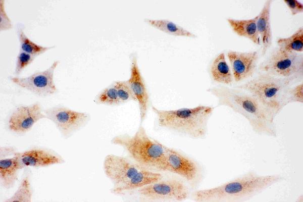 IHC analysis of DCI using anti-DCI antibody (PA1763). DCI was detected in immunocytochemical section of human A549 cell. Enzyme antigen retrieval was performed using IHC enzyme antigen retrieval reagent (AR0022) for 15 mins. The cells were blocked with 10% goat serum. And then incubated with 1μg/ml rabbit anti-DCI Antibody (PA1763) overnight at 4°C. Biotinylated goat anti-rabbit IgG was used as secondary antibody and incubated for 30 minutes at 37°C. The section was developed using Strepavidin-Biotin-Complex (SABC)(Catalog # SA1022) with DAB as the chromogen.