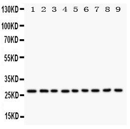 Anti-Kallikrein 6 antibody, PA1767, Western blotting All lanes: Anti Kallikrein 6 (PA1767) at 0.5ug/ml