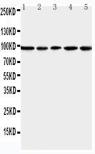 Anti-MCM6 antibody, PA1769, Western blotting Lane 1: U87 Cell Lysate Lane 2: COLO320 Cell Lysate Lane 3: HELA Cell Lysate Lane 4: MCF-7 Cell Lysate Lane 5: JURKAT Cell Lysate