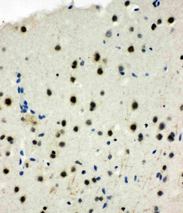 Anti-MCM6 antibody, PA1769, IHC(P) IHC(P): Rat Brain Tissue