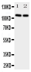 Anti-NRP2 antibody, PA1771, Western blotting All lanes: Anti NRP2 (PA1771) at 0.5ug/ml