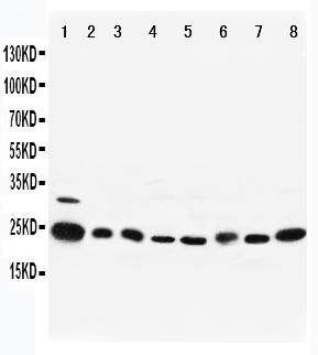 Anti-Rab5 antibody, PA1773, Western blotting Lane 1: Rat Brain Tissue Lysate Lane 2: Rat Ovary Tissue Lysate Lane 3: Human Placenta Tissue Lysate Lane 4: HELA Cell Lysate Lane 5: 293T Cell Lysate Lane 6: A375 Cell Lysate Lane 7: COLO320 Cell Lysate