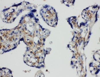 Anti-SNAP23 antibody, PA1774, IHC(P) IHC(P): Human Placenta Tissue